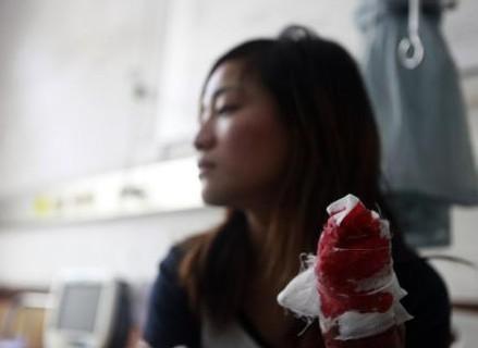 砍手环卫工：女子乱丢垃圾被环卫工砍断手指